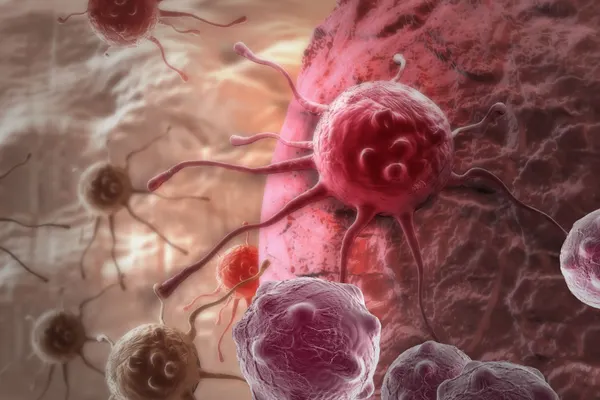 Evită aceste alimente! Pot cauza cancer