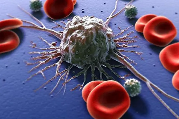 Aceste alimente hrănesc cancerul. Românii le consumă, din păcate, în fiecare zi