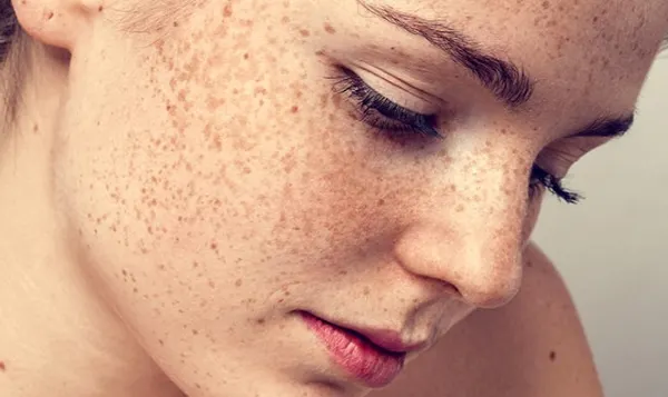 Cât de periculoşi sunt PISTRUII pentru sănătate. Avertismentul teribil al medicilor