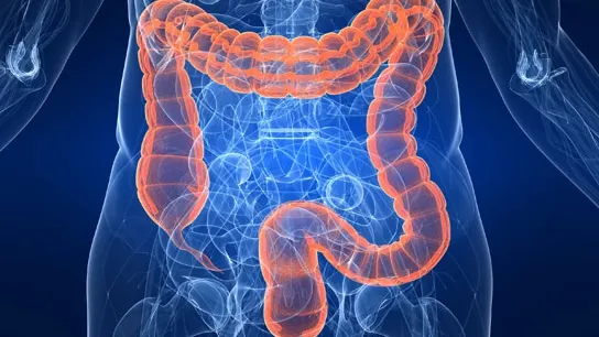 Aceste alimente opresc răspândirea cancerului de colon