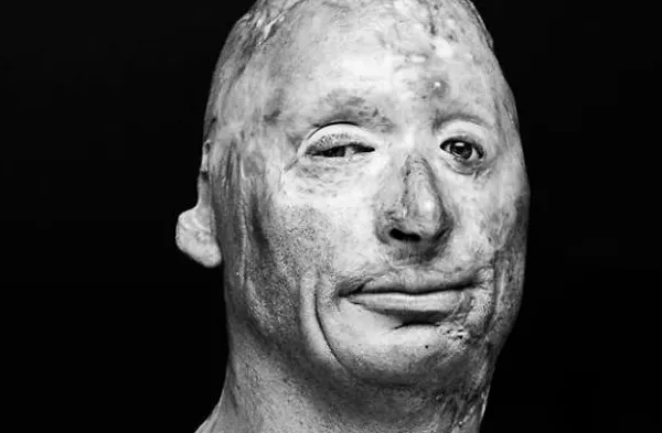 Urmele războiului pe trupurile soldaţilor! Fotografii emoţionante cu oameni mutilaţi pe viaţă