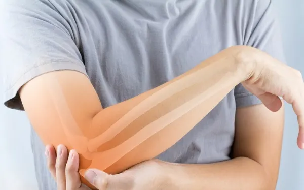 Cele două alimente interzise persoanelor care suferă de reumatism