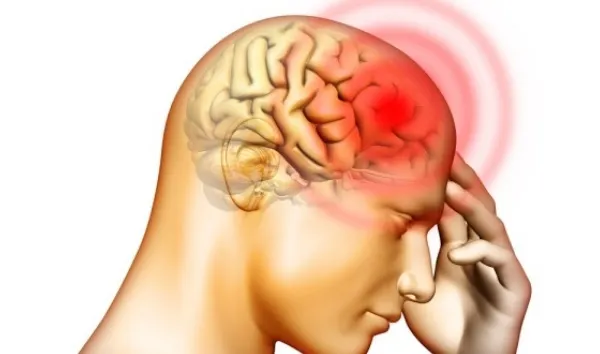 Semne trecătoare care pot anunţa un accident vascular cerebral