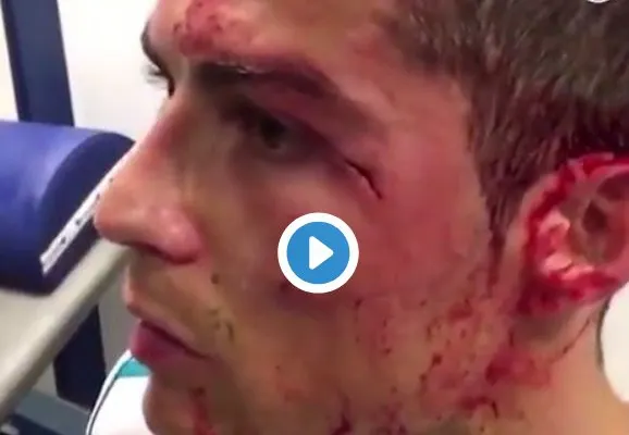 Imagini crunte cu Cristiano Ronaldo, accidentat