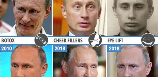 Putin, luat la ochi! Şi-a făcut operaţii estetice ca să scape de faţa de tocilar?! (GALERIE FOTO)