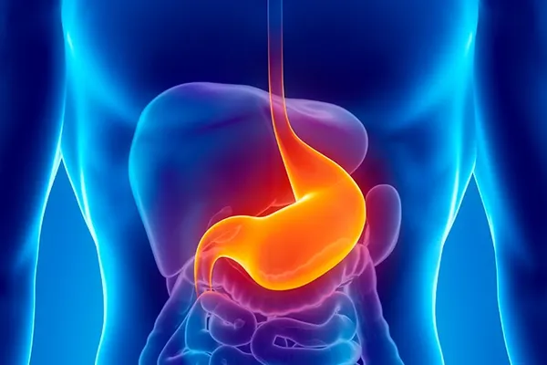 Alimentele care provoacă refluxul gastroesofagian. Tu le consumi?