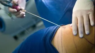 O liposucție făcută în Italia i-a pus capăt zilelor unei tinere românce