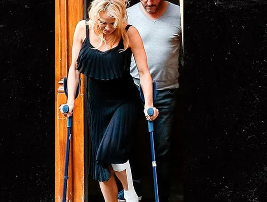 Pamela Anderson,  în cârje, după accidentarea suferită