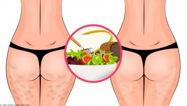 Ai celulită? Poţi scăpa rapid de ea, renunţând la câteva alimente. Ştii care sunt?