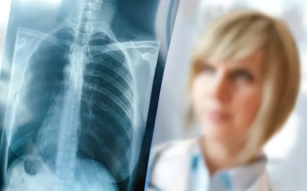 Focarul de pneumonie face noi victime în Argentina: 6 morți. Medicii au stabilit cauza îmbolnăvirilor misterioase
