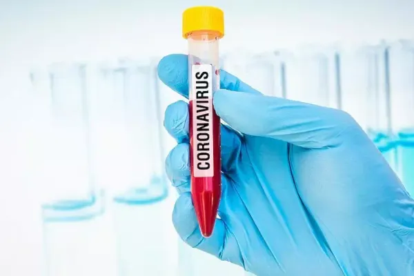 Coronavirus în Italia. Informații esențiale pentru românii din zonă - Unde pot apela pentru ajutor