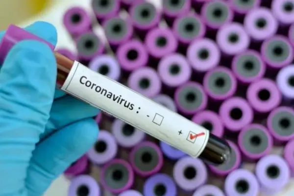 Bilanț NEGRU al deceselor, în Germania. Autoritățile iau în calcul impune noi restricții pentru perioada Sărbătorilor de iarnă