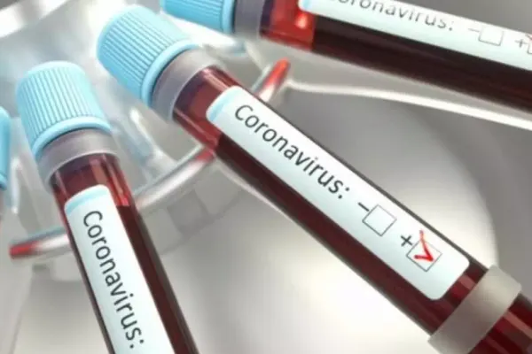 Focar de coronavirus la Institutul Național de Neurologie din București: 22 de persoane infectate cu COVID-19