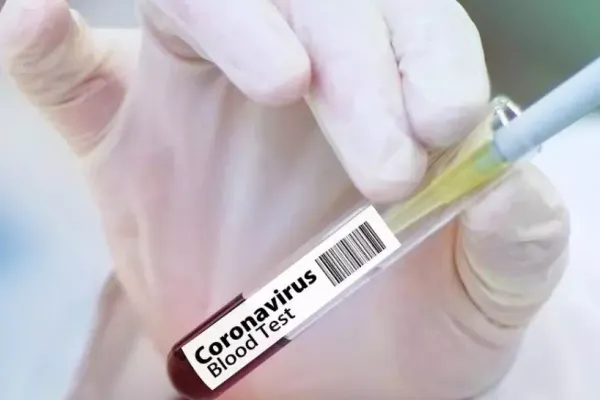 Focar de coronavirus într-un cămin de servicii comunitare din Buzău: 17 persoane diagnosticate pozitiv