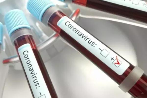 Focar de coronavirus la o fabrică din Brăila. Mii de angajați în pericol, patronul refuză oprirea activității