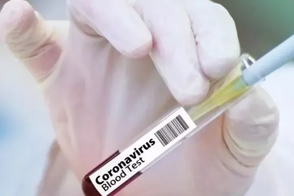 Focar de COVID la Spitalul Județean Arad. Numărul cadrelor medicale infectate s-a dublat în ultimele 10 zile!