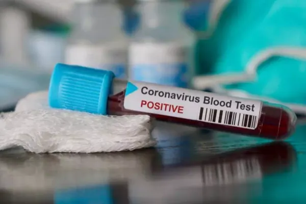 Focar de Covid-19 la Spitalul de Ortopedie Azuga. Niciun loc liber la ATI în județ