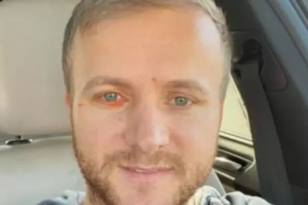 Activistul de mediu Daniel Bodnar, acuzații grave: radiografie la piciorul greșit, după accident