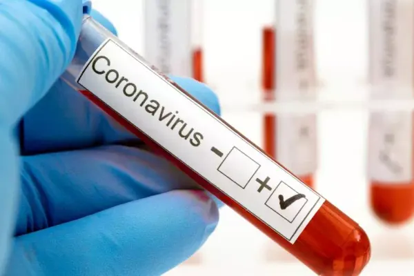 Șase focare de coronavirus, în județul Timiș. Trei dintre ele sunt în spitale