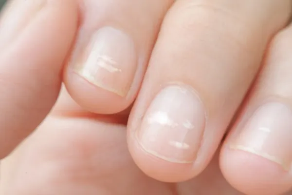 13 probleme de sănătate pe care ni le dezvăluie forma semilunii de pe unghii