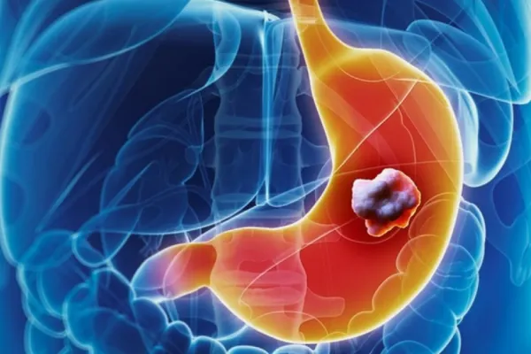 Alimentul banal care face minuni pentru sănătate. Previne bolile cardiovasculare și ajută împotriva cancerului de colon