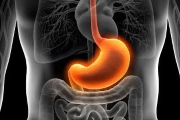 Alimentele interzise în GASTRITĂ. Când devine o afecțiune periculoasă și este nevoie de biopsie