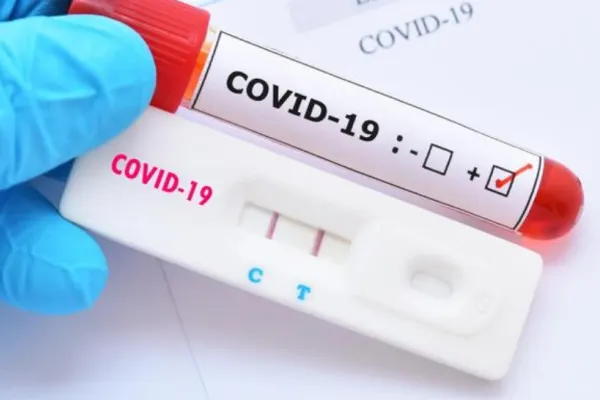Scădere accentuată a cazurilor de COVID-19 față de săptămâna precedentă - Cele mai noi cifre anunțate de Ministerul Sănătății