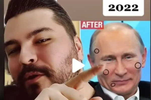 VIDEO – Un medic român face dezvăluiri despre intervențiile chirurgicale ale lui Putin: “Doctorul care le-a făcut nu mai e printre noi”