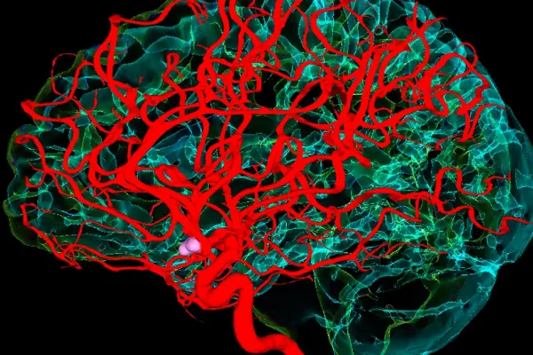 Accident Vascular Cerebral. Cum te recuperezi după un AVC. Ce simptome post-AVC poți avea