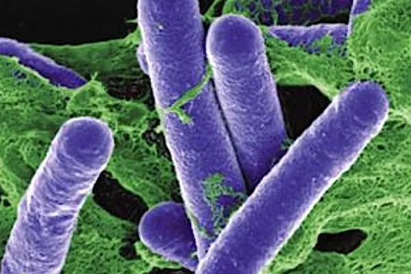 Un nou caz de botulism în România: Un bărbat de 68 de ani din Slatina, la Terapie Intensivă - De la ce alimente s-a infectat