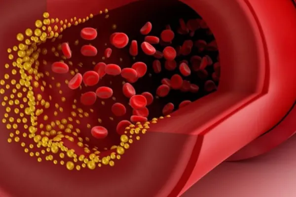 Alimentele care curăță vasele de sânge de colesterol și reduc riscul de infarct