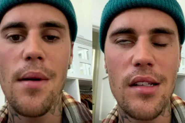 Justin Bieber, probleme grave de sănătate - Și-a anulat toate concertele din turneul său mondial