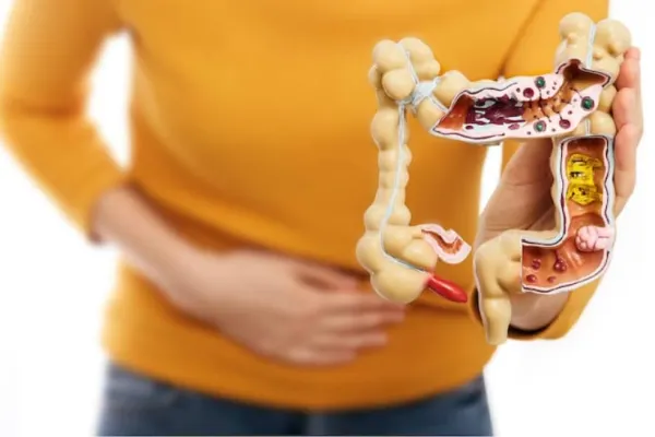 Sfaturi de la nutriționiști. O metodă foarte ușoară de a îmbunătăți sănătatea intestinală