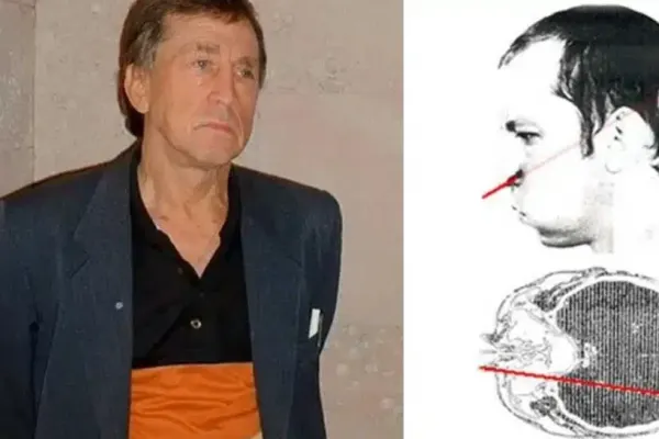 Și-a băgat capul în aceleratorul de particule și prin creier i-a trecut o rază ca de LASER. Accidentul i-a SCHIMBAT viață