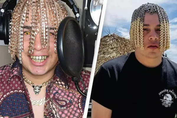 Un rapper care și-a implantat lanțuri de aur în cap, care să semene cu părul, a pus pe jar medicii. „Ar putea fractura craniul”