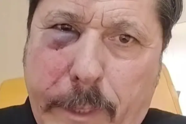 Noi detalii despre consilierul AUR bătut într o ședință de consiliu din Ilfov. Bărbatul a ajuns la spital și a fost operat de urgență