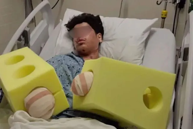 Adolescent mutilat de o petardă găsită pe stradă! Și-a pierdut mai multe degete, iar medicii încearcă să-i salveze mâna