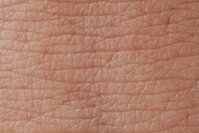 Vitamina asociată cu un risc mai mic de cancer de piele. Ce spun dermatologii