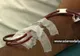 Aparatul care curăţă sângele de viruşi şi toxine a fost proiectat în SUA