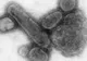 Vaccinul împotriva gripei porcine este suspectat că provoacă o boală neurologică rară 