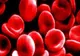 Lideri la SIDA! Cei mai mulţi bolnavi din Europa Centrală şi Est-Europeană sunt din România