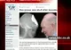 Unui britanic i s-a refăcut craniul distrus într-un accident 