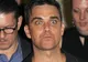 Robbie Williams a călcat un fotograf cu maşina