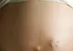 Avorturile nesigure ucid 70.000 de femei anual