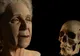 Reconstrucţie facială: rezultate incomparabile, graţie imprimantelor 3D