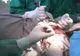SUPER BACTERIA de spital care îi sperie pe specialiști. Se hrănește cu plasticul din bandaje și implanturi