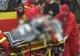 Dezvăluirile șocante ale medicului care a filmat larvele de la Spitalul de Arși