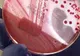 Cazul bebeluşilor infectaţi cu bacteria ucigaşă nu e singular. În Germania,criza a ucis 53 de oameni
