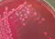 Ce este bacteria E.coli: cum se transmite şi cum poate fi prevenită infecţia. Primele simptome