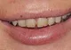 Află ingredientul secret care îți menține gingiile sănătoase